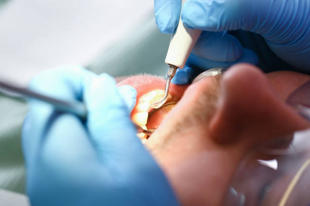 Best Dentist Open Late Near Me  in Dunn Loring, VA