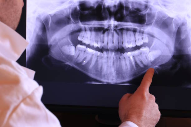 Best Broken Tooth Emergency  in Dunn Loring, VA