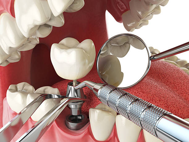 Best Cracked Tooth Emergency Dentist  in Dunn Loring, VA